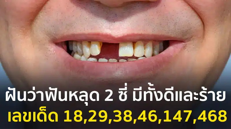 ฝันว่าฟันหลุด 2 ซี่